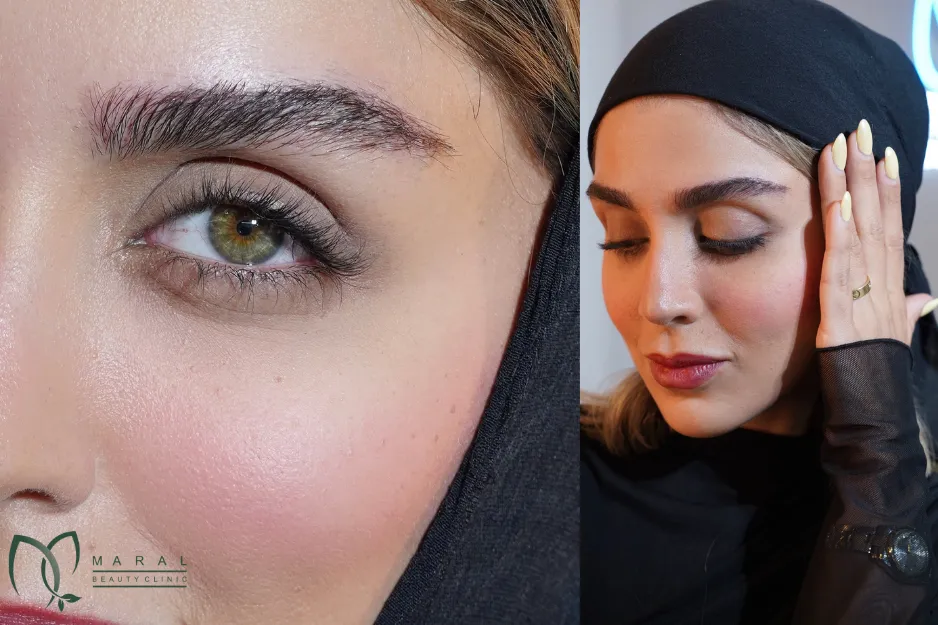آیا کاشت ابرو بیهوشی دارد؟