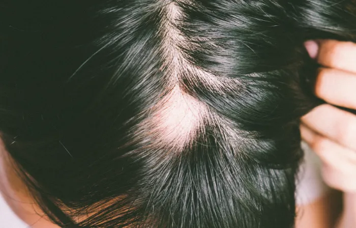 کاشت ابرو برای چه کسانی ضرر دارد؟