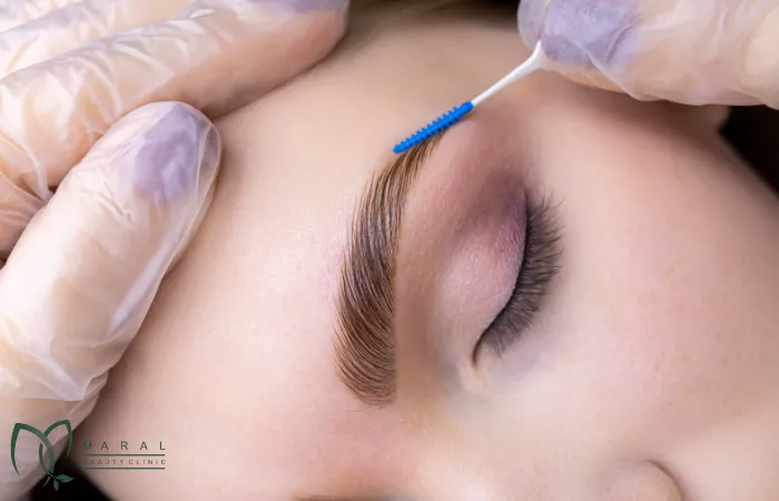 کاشت ابرو روی جای زخم و اسکار