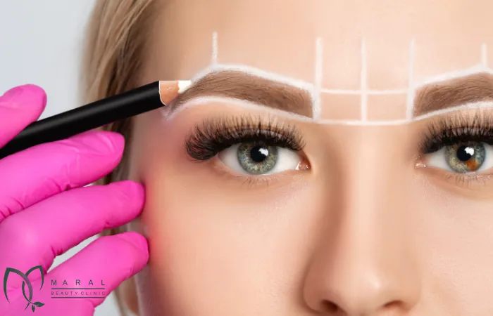 میکروبلیدینگ یا کاشت ابرو
