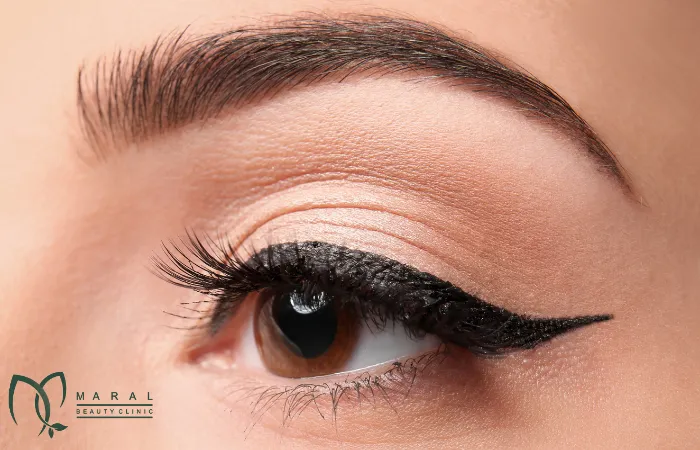 کاشت ابرو به روش fit