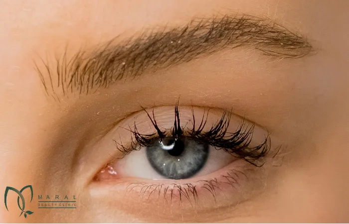 کاشت ابرو برای افراد دیابتی