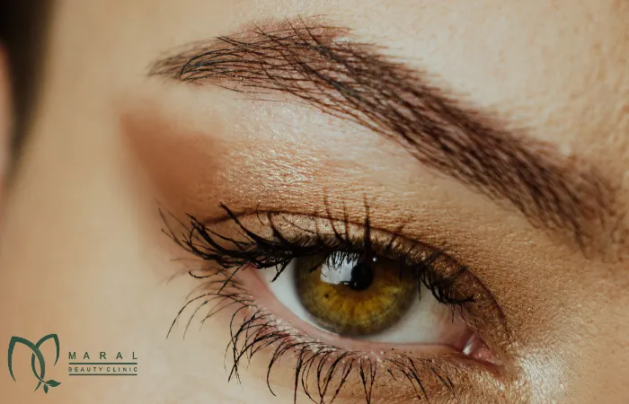 کاشت ابرو برای افراد دیابتی