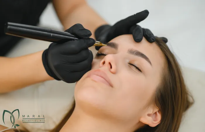 کاشت ابرو به روش sut چگونه است؟