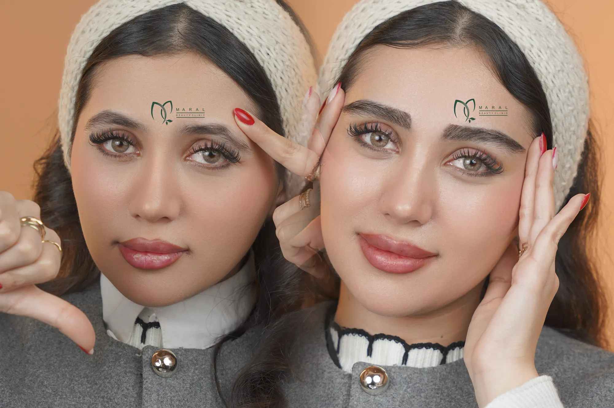 هزینه کاشت ابرو طبیعی
