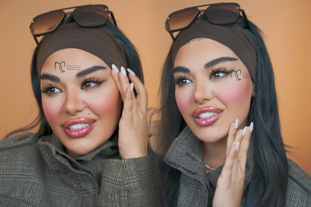 عکس کاشت ابرو