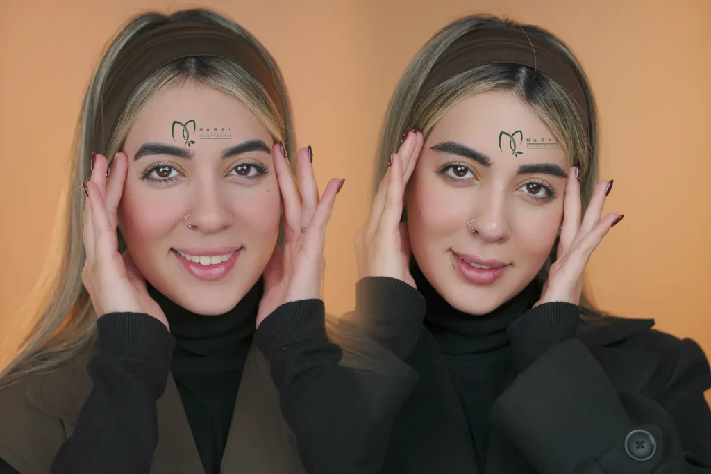 مدل کاشت ابرو طبیعی