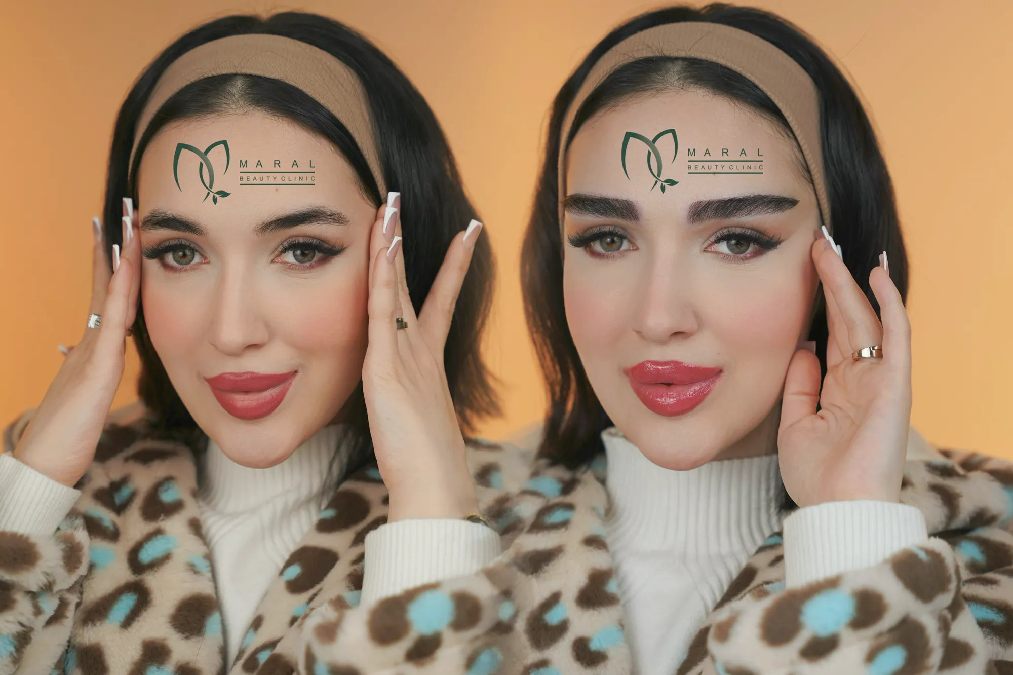 کاشت ابرو طبیعی