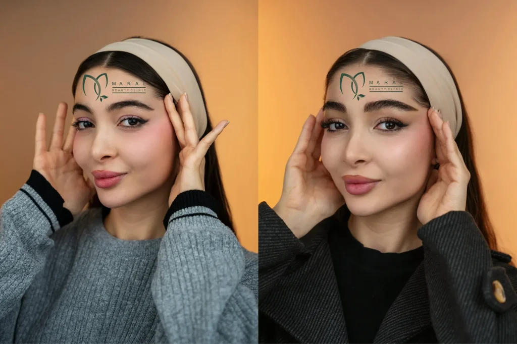 مدل کاشت ابرو طبیعی
