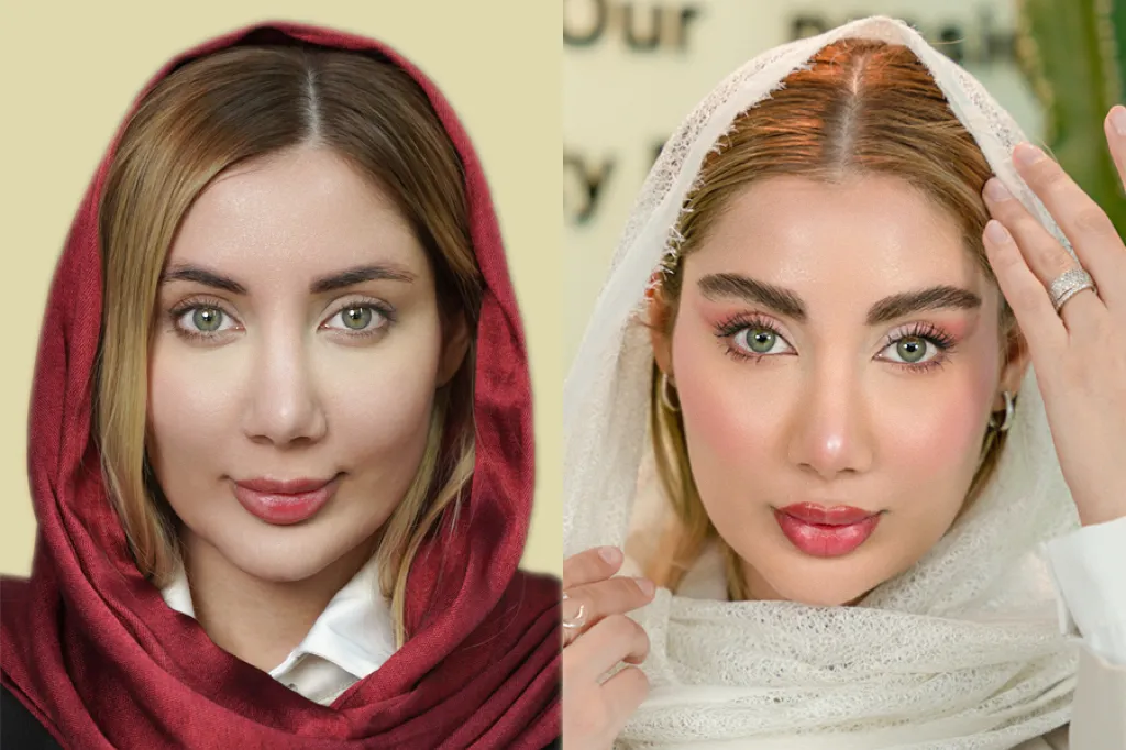 بعد از کاشت ابرو چه روغنی استفاده کنیم