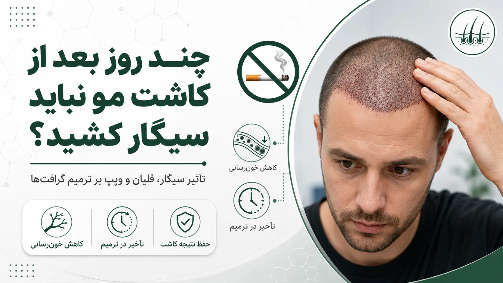 چند روز بعد از کاشت مو نباید سیگار کشید و تأثیر سیگار، قلیان و ویپ بر ترمیم گرافت‌ها