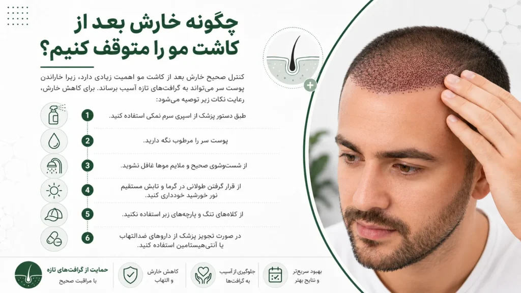 روشهای کنترل و متوقف کردن خارش بعد از کاشت مو بدون آسیب به گرافتها