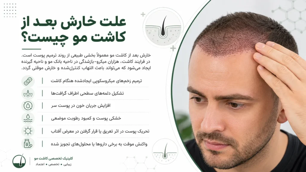 علت خارش بعد از کاشت مو و دلایل ایجاد التهاب، دلمه و خشکی پوست سر