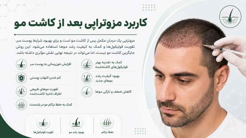 کاربرد مزوتراپی بعد از کاشت مو برای تقویت فولیکول‌ها و بهبود شرایط پوست سر