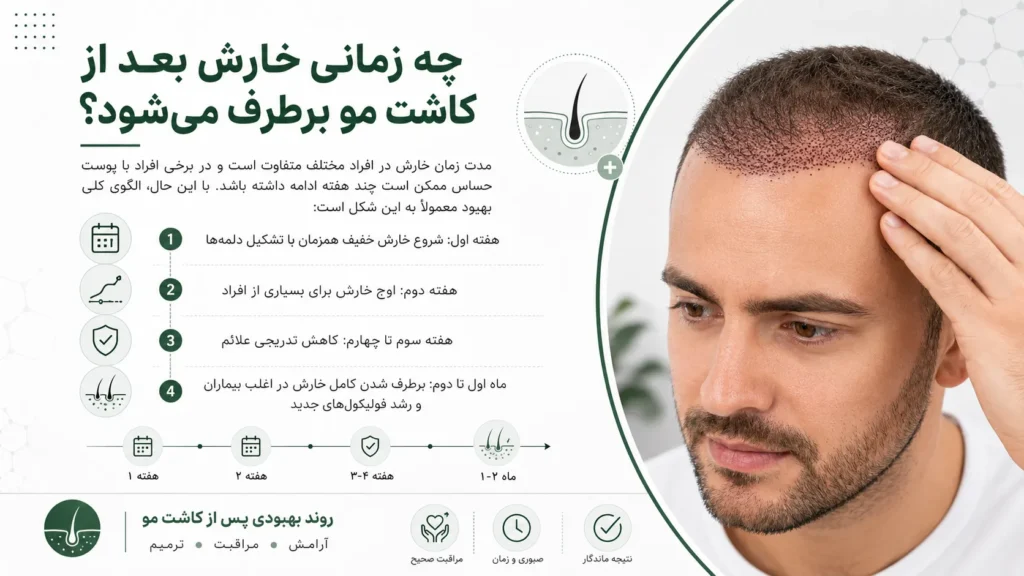 زمان برطرف شدن خارش بعد از کاشت مو از هفته اول تا ماه دوم