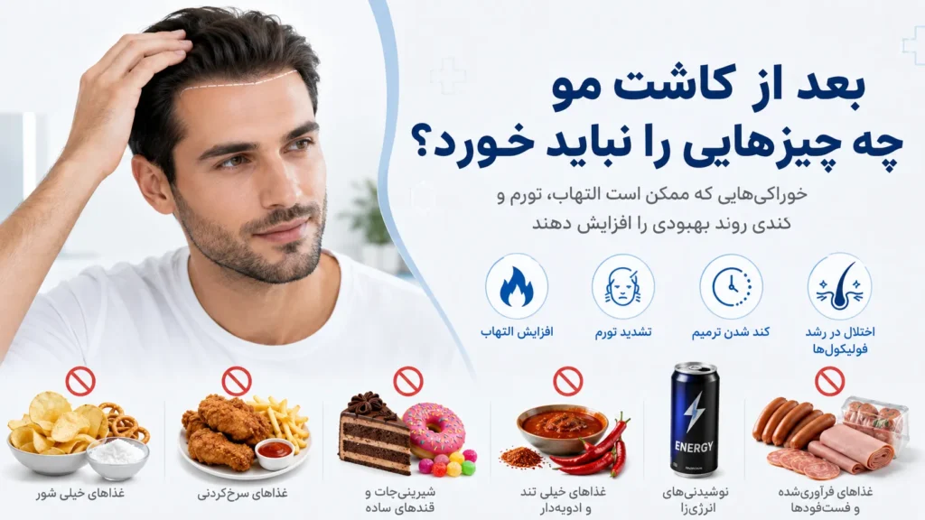 بعد از کاشت مو چه چیزهایی را نباید خورد؟