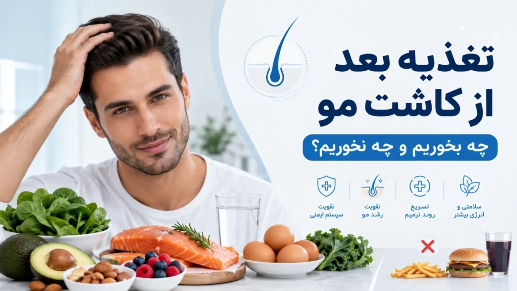 تغذیه بعد از کاشت مو؛ چه بخوریم و چه نخوریم؟