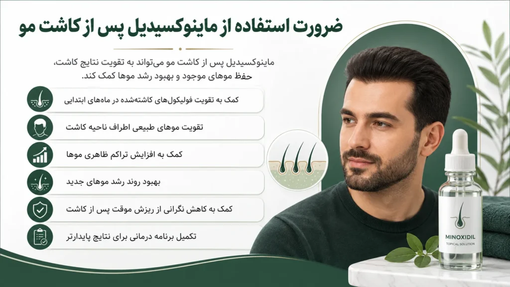 ضرورت استفاده از ماینوکسیدیل پس از کاشت مو