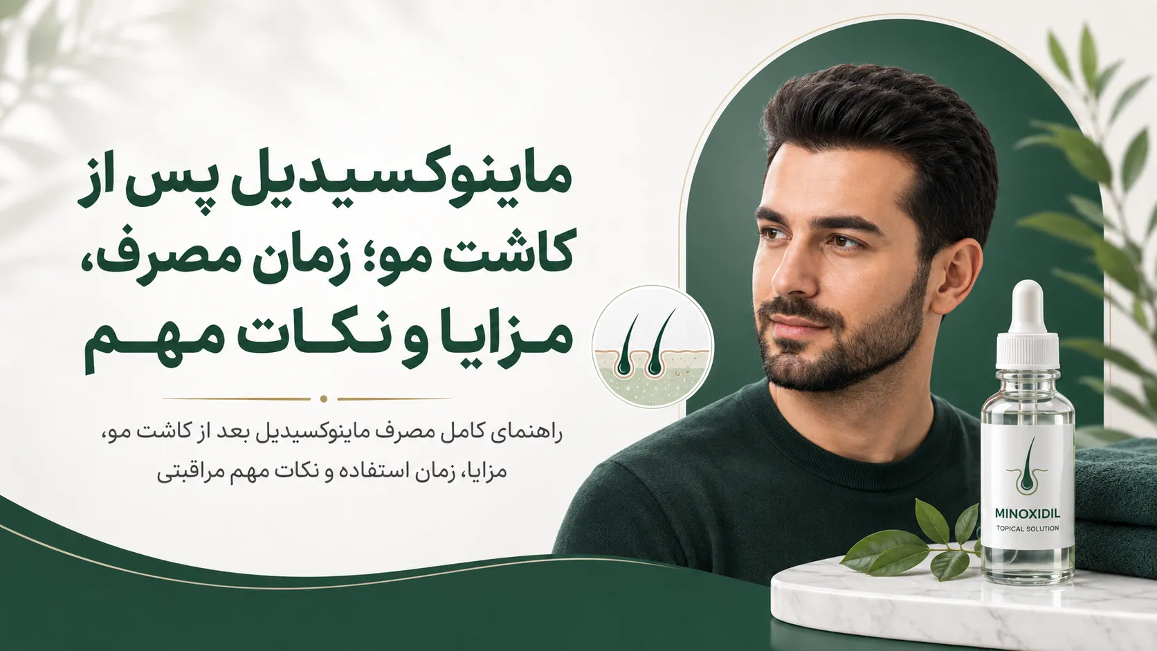 ماینوکسیدیل پس از کاشت مو؛ زمان مصرف، مزایا و نکات مهم
