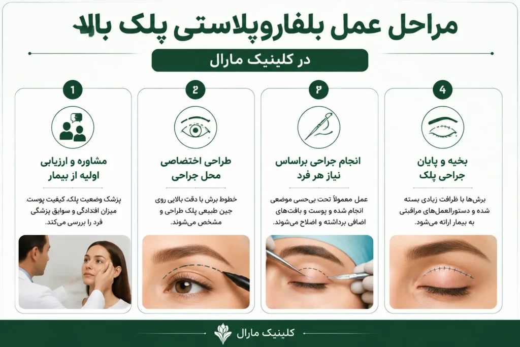 مراحل عمل بلفاروپلاستی پلک بالا در کلینیک مارال