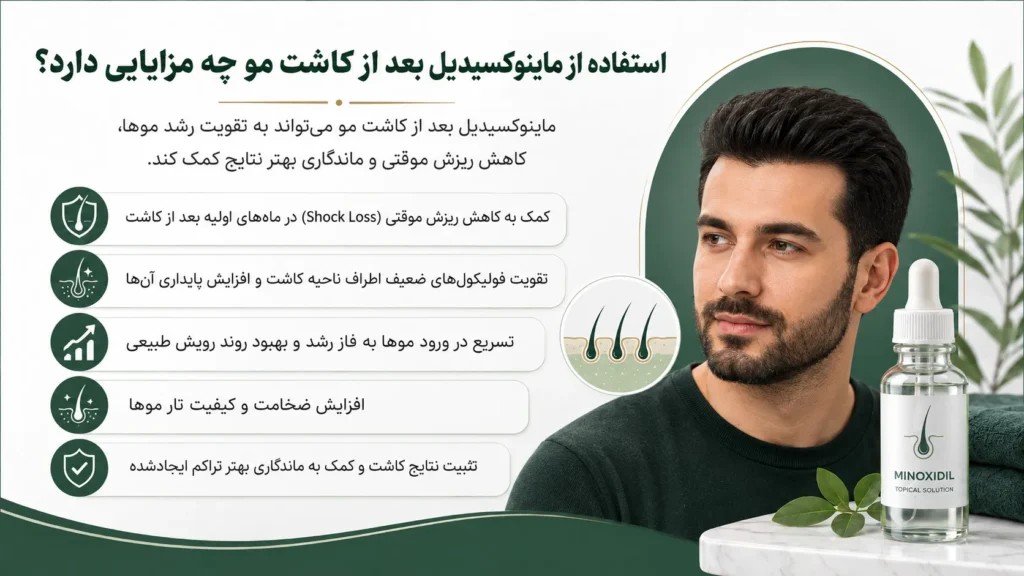 مزایای استفاده از ماینوکسیدیل بعد از کاشت مو