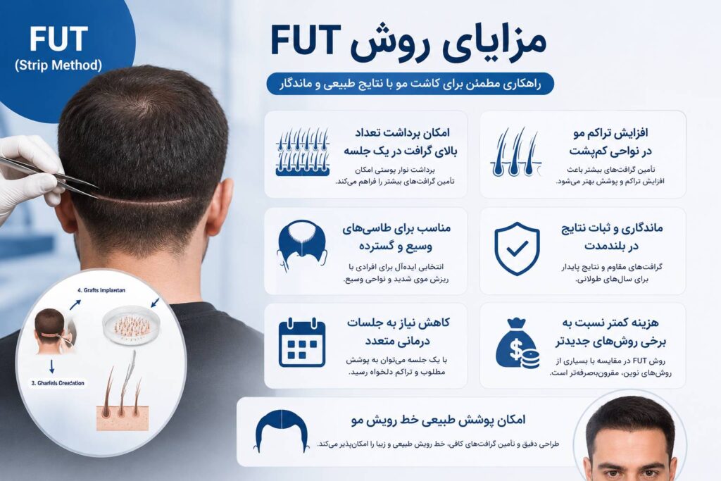 مزایای روش FUT