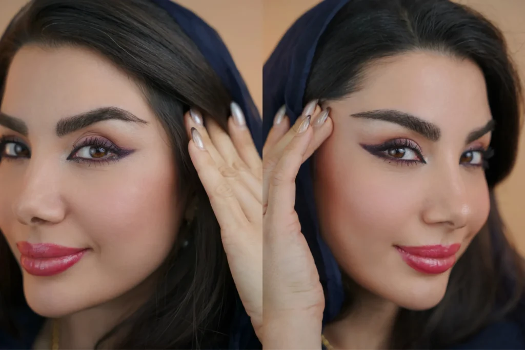 مقایسه قبل و بعد کاشت ابرو با خواب طبیعی مو