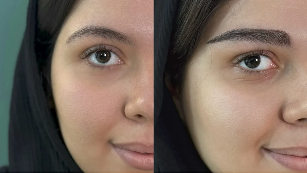 نتیجه نهایی کاشت ابرو برای ابروهای کم پشت