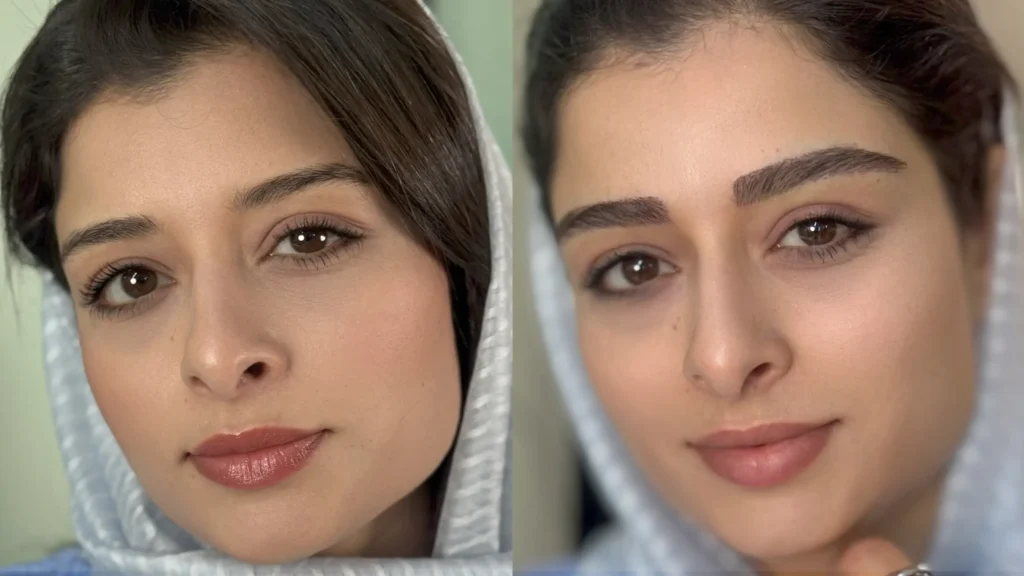 نتیجه کاشت ابرو قبل و بعد با تراکم طبیعی موها