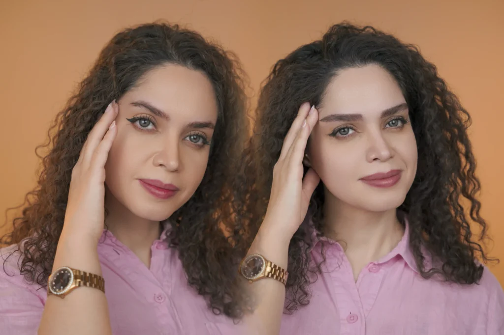 نمونه کاشت ابرو طبیعی برای اصلاح نازکی ابرو