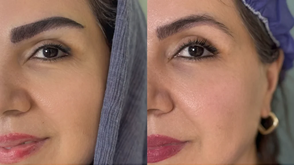 نمونه کاشت ابرو قبل و بعد برای ابروهای خالی